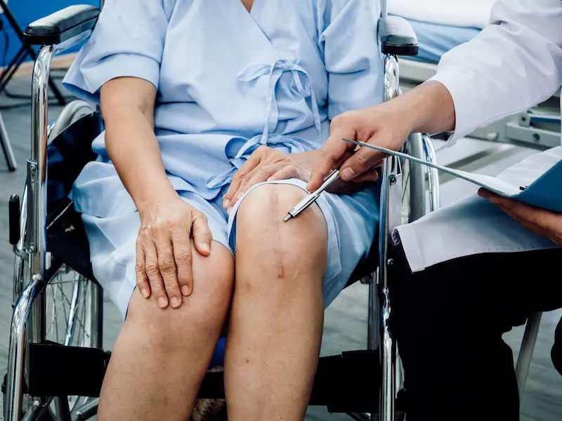 Total Knee Replacement Busting 10 Common Myths with Facts